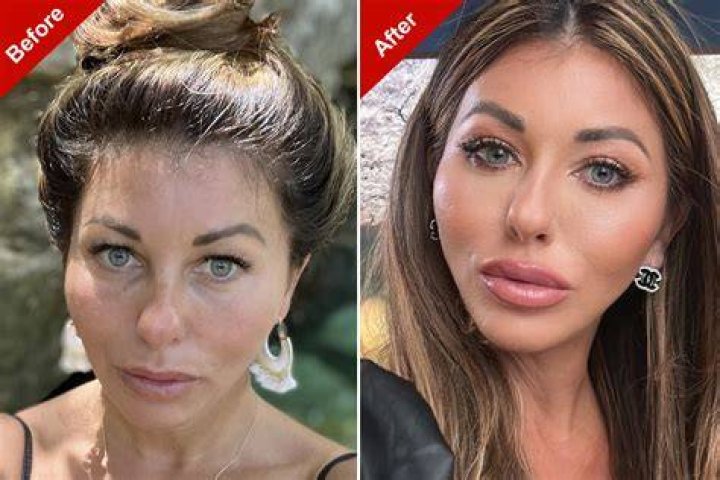 Coi Leray | Has She Done Plastic Surgery