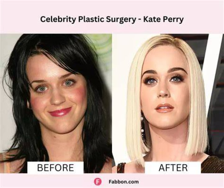 Sara Rue | Plastic Surgery | Before And After